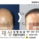 모재성성형외과의원 이미지