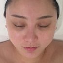 네박자 | 용인 피부관리, 처인구 빛담스킨랩｜김량장동 피부관리로 뒤집어진 피부 되살린 후기