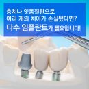 지행수치과의원 | 지행역치과 임플란트 잘하는곳 지행수치과의원
