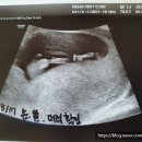 호산여성의원 이미지