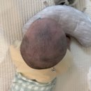 아이사랑두헬멧 부산센터 | 사경, 사두증, 대천문 좁은 아기 두상 교정 과정 2탄 (아이사랑두 헬멧 부산센터)