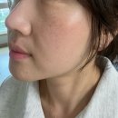 관리받아야예쁘다 | 송도피부관리 추천 예쁘다에스테틱 하이푸리프팅 후기