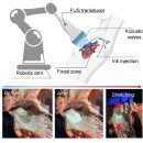 초음파로 몸속에서 출력하는 3D 프린팅 기술 이미지