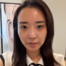 닥터보청기 | 성남 모란역 피부관리 오라스킨케어 여름 늘어진 모공 케어 후기