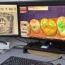 정교한치과기공소 이미지