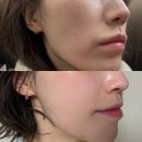 오일하우스 | 오일 레티놀 바쿠치올 여드름 케어 후기｜결 하우스 익스트림 카밍 티트리 오일 모공 붉은기 케어...