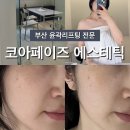 코아신발 | 부산 서면 전포 에스테틱 추천 : 코아페이즈 윤곽 탄력 리프팅 리뷰 후기