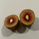 삼성미즈 앞 | 출산후기 | 천안 삼성미즈병원 제왕절개 후기, 편안했던 입원생활