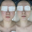 클레어 | 수원 인계동 윤곽관리 전문 에스테틱 후기, 클레어스킨