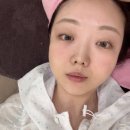 원미술 - 송파구 석촌호수로18길 16-10 | 부천 원미구 피부과 스킨부스터 셀르디엠 눈밑 앞광대 리얼 후기