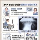 경추베게추천, 거북목교정 네이버 넾다세일 밀라베개 사용 찐 후기