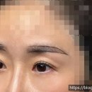 블랙브로우