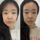 원흥제2주유소 | [공지] 내돈내산 신부관리 고양 원흥 에스테티아 윤곽관리 중간후기