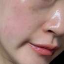 중로(보)1-3-5 | [올영추천] 집에서 슈링크 기기? 바이오힐보 콜라겐 세럼 1+1 홈케어 후기