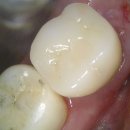 성원치과기공소 이미지