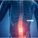 서울강한정형외과의원 이미지