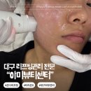 온다유도아카데미 | 대구 리프팅관리 온다의 쫀쫀함을 재현한 티리온X,아미뷰티 솔직 리뷰