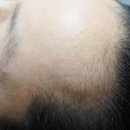 플로라 뷰티라인 이미지