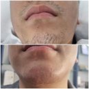 뷰티호텔 미장점 | 군산왁싱/뷰티호텔미장점 왁싱 후기^^