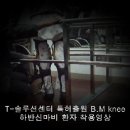 자동보조기 B.M knee 자동조기 하반신 마비 환자 착용영상 이미지