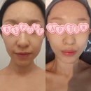 병점2로 | 에스테티아 병점점 윤곽/데콜테 관리 후기