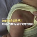 심낭골 | 신생아 bcg피내용 접종 이유 및 후기(피내용vs경피용 차이, 접종가능 병원 찾기)