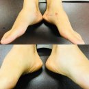 인천 카이로프랙틱 전문 포스츄어 바른자세 체형원
