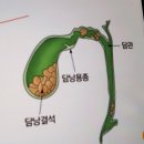 굿모닝내과병원 | 굿모닝병원 건강검진후기,담낭용종,복부CT,동탄한림대 소화기내과 진료,동탄한림대 초음파