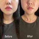수성구피부관리 더블유테라피에서 에센셜 리프팅 부스트 케어 받고 온 후기✨