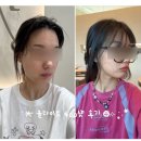 400 | 수원 리프팅 잘하는 피부과 올타이트 400샷 후기