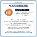 에이스안경 | 강남에이스안과 백내장 수술 후기 (백내장 증상, 수술비용, 수술방법, 수술후 주의사항)