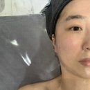 뷰티에이 | 불당동 피부관리 :: 뷰티에이 물방울리프팅 후기
