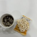 마리엠산부인과의원 | 미레나 후기 최종!_6개월 후의 변화