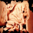 한사랑산부인과의원 | [임신27주차] 28. 입체초음파 김건우산부인과(feat. 분만병원 전원하기)