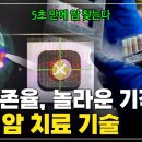 “5초 만에 암 찾는 기술” 혁신적 치료 등장! 한국, 암 치료 역사를 바꾸다 [Science PD Pick] 이미지