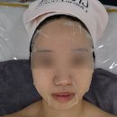 [익산 피부관리] 익산 피부관리 잘하는 곳, 어썸제이 미백토닝 후기