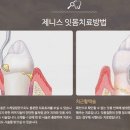 서울제니스치과의원 이미지
