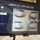 고운:결 | 평생 숙제 색소 잡티 고민 해결 부평피부관리 결이고운 후기