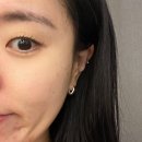 루미나 | [잠실 에스테틱] 루미나에스테틱｜물폭탄 LDM 관리 후기😶‍🌫️