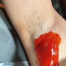 Waxing거기 네이버블로그