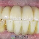 RPD치과기공소 이미지