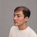 명인환경 | 대구가발 30대 초반 직장인 스트레스 탈모 고민 찐 리뷰 보고 찾아간 달서구 가발명인 대만족 후기