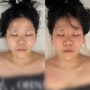 덕풍제2공영주차장1F | 대구 두류동 1인 에스테틱 샵 민감한 피부 윤곽 케어 받고 온 후기