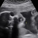 예스율산부인과의원 이미지