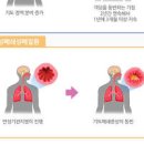 목련꽃차 신이화 효능 부작용 이미지