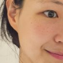 메디블랙 | 부평피부관리 홍조케어 크라이오 진정관리 데자뷰메디스킨인천 후기
