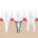 하양탑치과 이미지