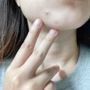 진 메디케어 이미지