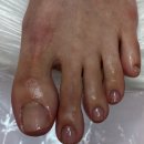 레푸스 정자점 | 멍든발톱/발톱스케일링/발톱무좀/발각질제거/레푸스분당정자점/이유진 푸스플레게/관리 받은 후기