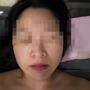 민락동 신부관리 고이고이 에스테틱 하이푸+물방울 관리 리얼 후기
